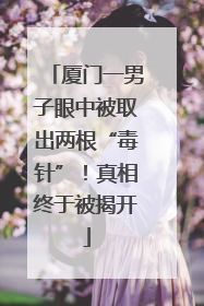 厦门一男子眼中被取出两根“毒针”！真相终于被揭开
